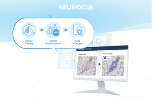 뉴로클, KSP 2025 참가...디지털 병리학 분야 진출 - 뉴스 썸네일 이미지