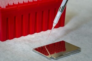 K-톡신 출혈경쟁 심화...승부처는 美·中 - 뉴스 썸네일 이미지